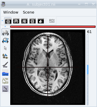 View of a T1 MRI in an axial window.
