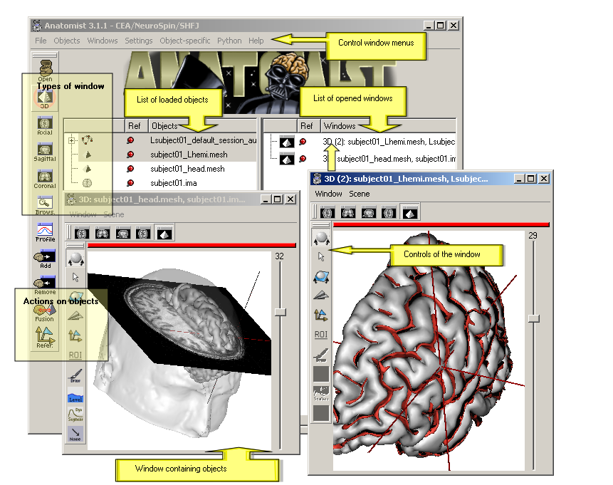 Anatomist control window