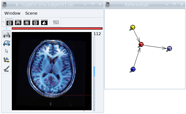 Anatomical MRI of 2 subjects in a common referential