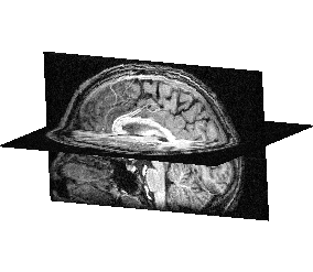 FusionSliceMethod: cut a volume across itself