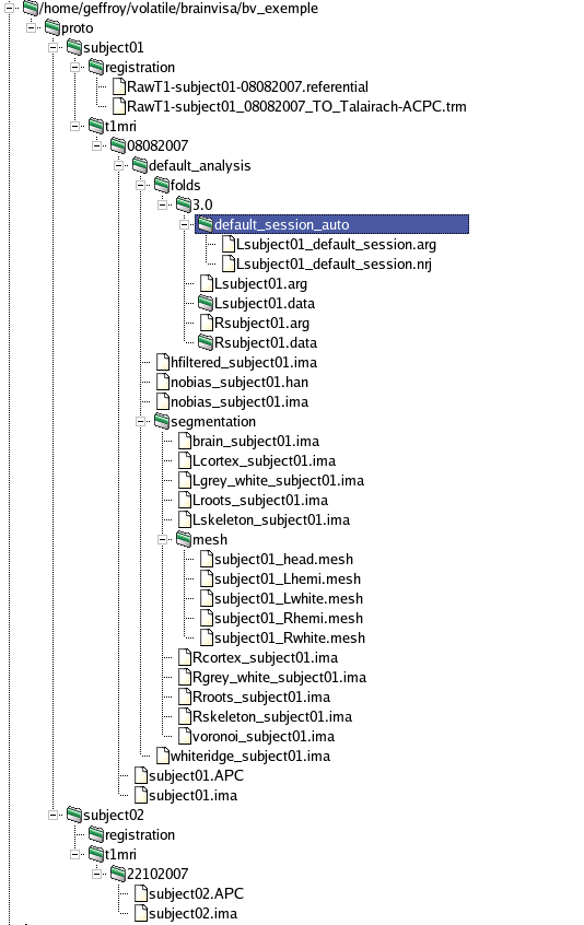 Example of a BrainVISA database containing T1-weighted data