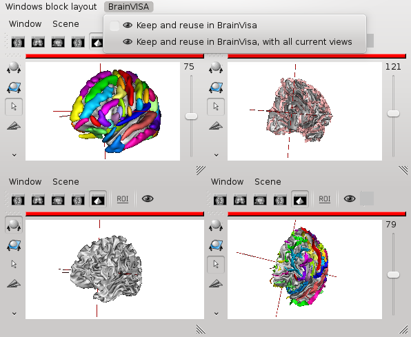 Reusable Anatomist windows blocks