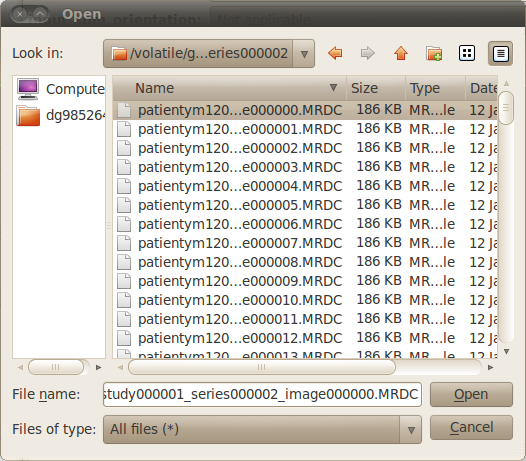 Selection of Dicom files