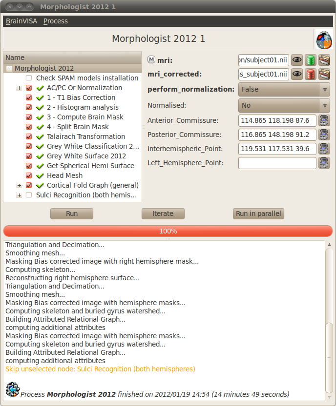 Morphologist pipeline