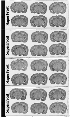 (a) Overall scan of histological sections stained with cresyl violet (three glass slides arranged in a column, 600 dpi). (b) Overall scan of corresponding [14C]-2DG autoradiographic sections. (c) Radioactive [14C] standards.
