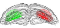 3-D reconstruction of the left and right manually segmented superior colliculus. The automatic extraction of the "activated" volume using the threshold method is represented in red and the symmetric volume in green.