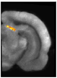 Brain area (the superior colliculus) in which CMRGlu was significantly higher or lower in visually stimulated hemibrains than in the corresponding control hemibrains automatically detected by a voxel-wise statistical analysis. Significance is indicated with t statistic color scales, corresponding to the level of significance at voxel level.