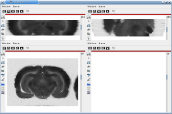 3D reconstruction of [14C]-2DG autoradiographic volume, encompassing a large part of the visual system (between bregma -5.2 mm and bregma -8.2 mm), in coronal, axial and sagittal views before (top) and after registration (bottom).
