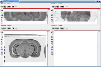 3D reconstruction of histological volume (Nissl stain) encompassing a large part of the visual system (between bregma -5.2 mm and bregma -8.2 mm), in coronal, axial and sagittal views before (top) and after registration (bottom).
